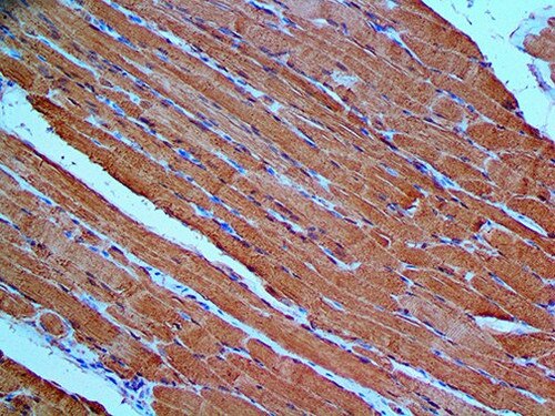 IHC of Myoglobin on an FFPE Skeletal Muscle Tissue